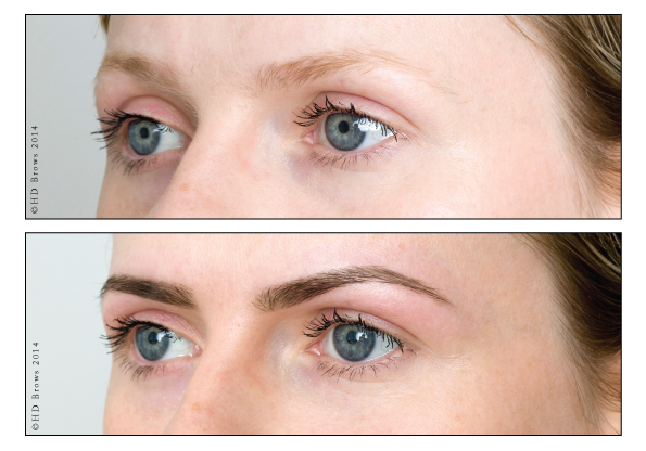 Before-and-Afters-Fair_LR